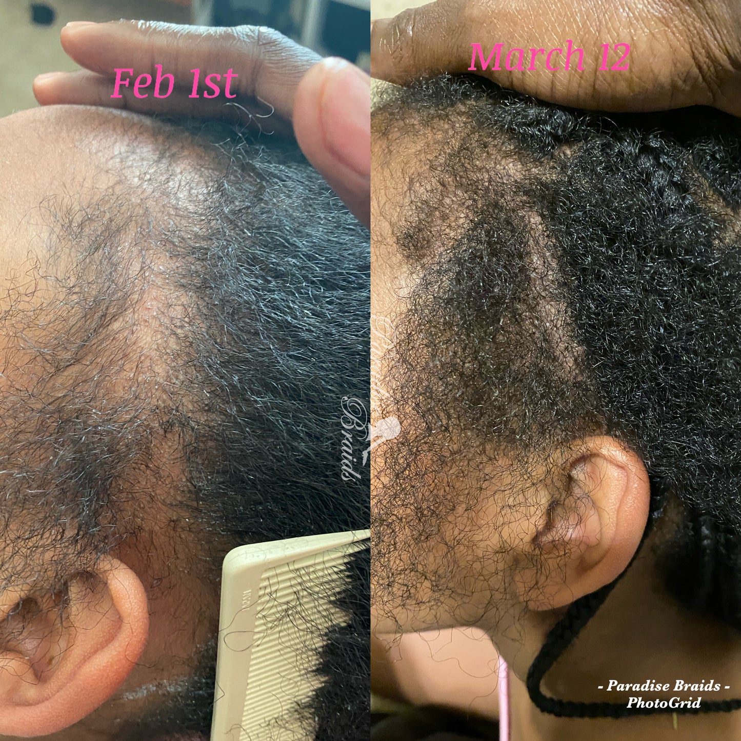 Paradise Braids Hair Oil